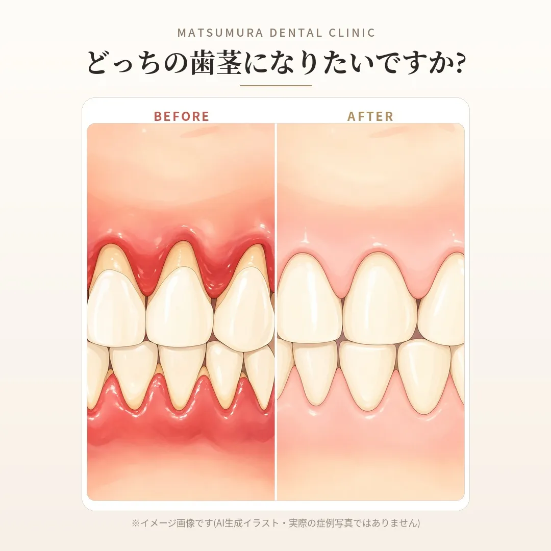 その歯茎、歯周病かも。