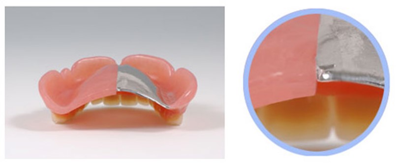 金属製とプラスチック製の入れ歯の違い